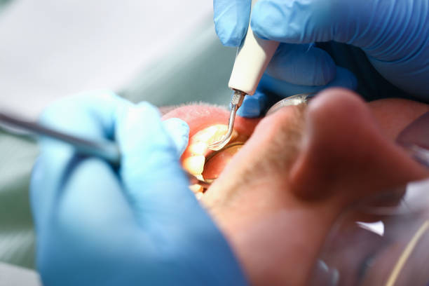Best Mobile Emergency Dentist in Smithville, TN