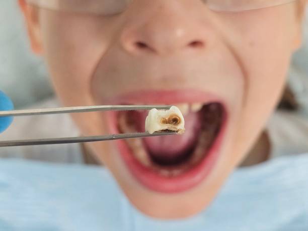 Best Weekend Emergency Dentist in Smithville, TN