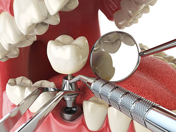 Best Emergency Dental Services for Seniors in Smithville, TN